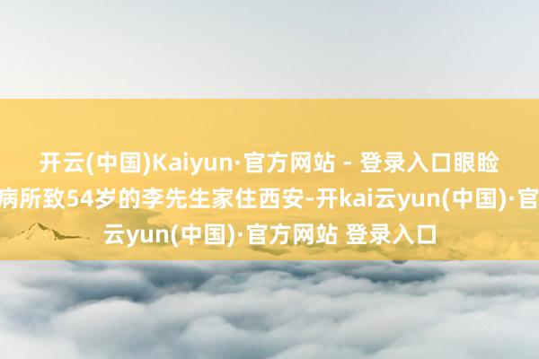 开云(中国)Kaiyun·官方网站 - 登录入口眼睑下垂真是是陌生病所致54岁的李先生家住西安-开kai云yun(中国)·官方网站 登录入口